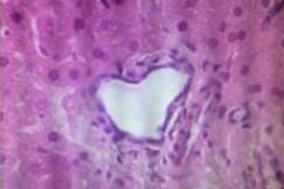 Imagem: imagem captada por microscópio de tecido hepático