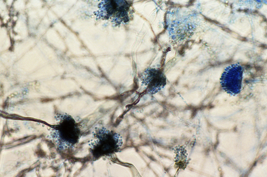 Imagem: Zoom microscópico em fungo A. fumigatus, que tem coloração azul 